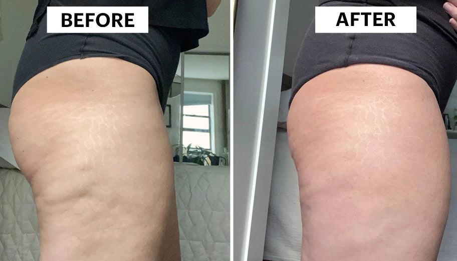 Before and after comparison of a person's legs with visible changes.